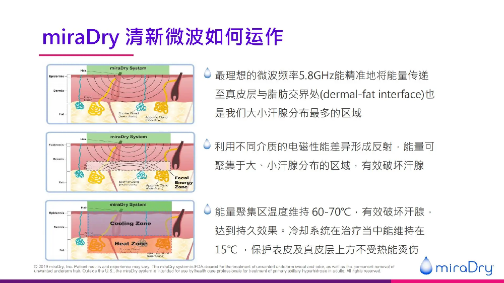 疗程工作方式