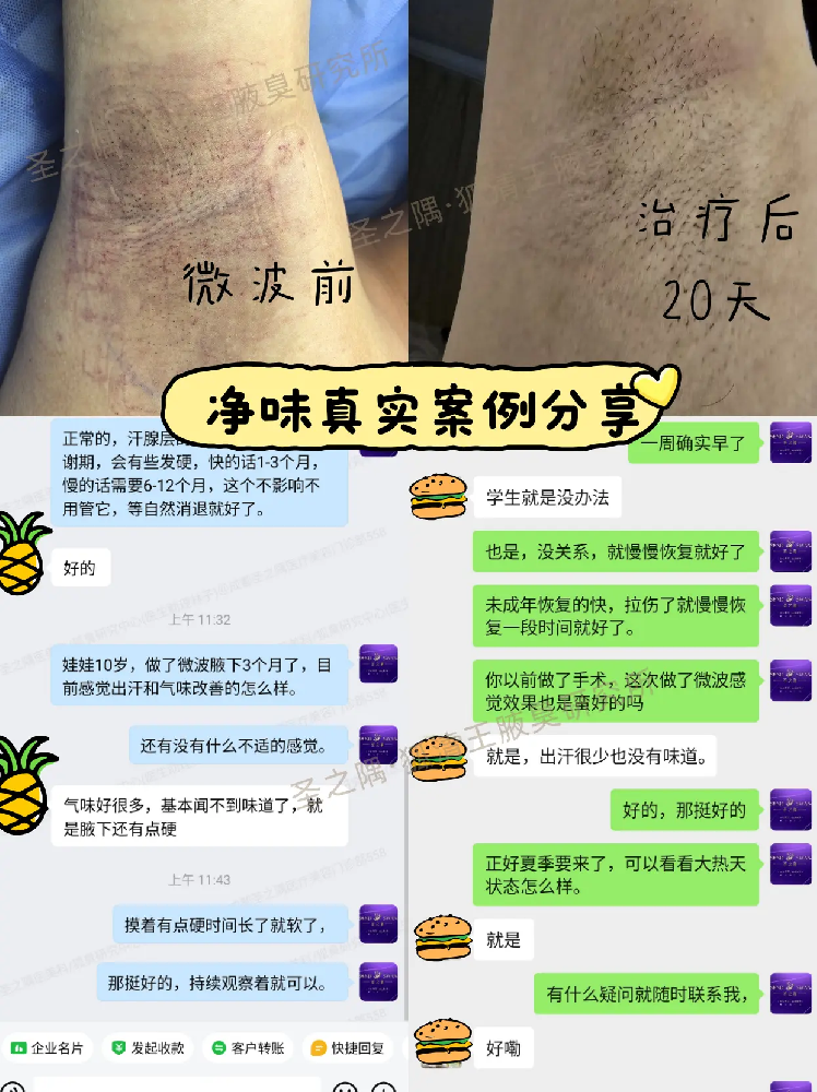 清爽状态展示